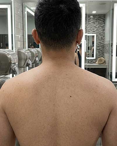 Before X-ray
